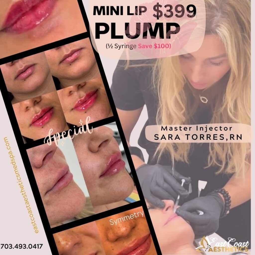 Mini Lip Plump Special $399 (Save $100) Chantilly VA - Sara Torres, RN