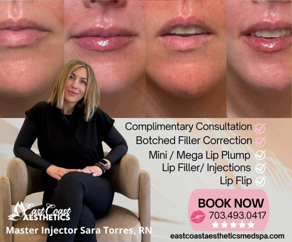 Botched Lip Filler Correction Chantilly VA Botched Lip Images